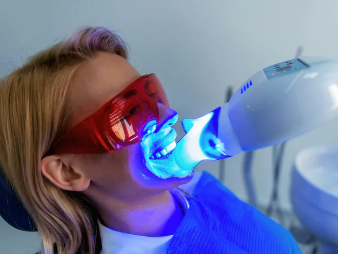 Teeth whitening in Tomball, TX at Willow Creek Smiles.